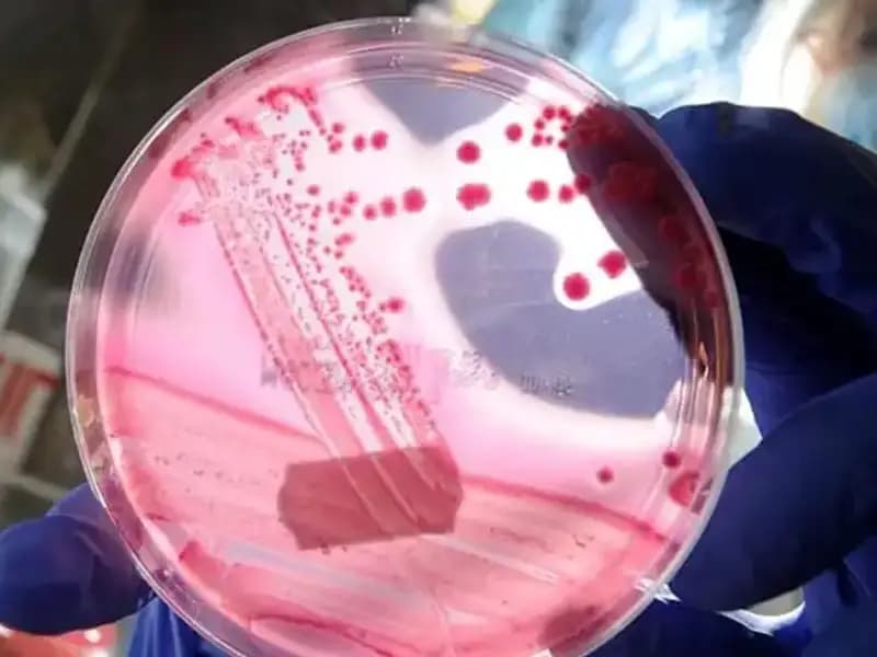 Yaşlanmayı Geri Alan Keşif: AP2A1 Proteini Üzerine Şaşırtıcı Bulgular