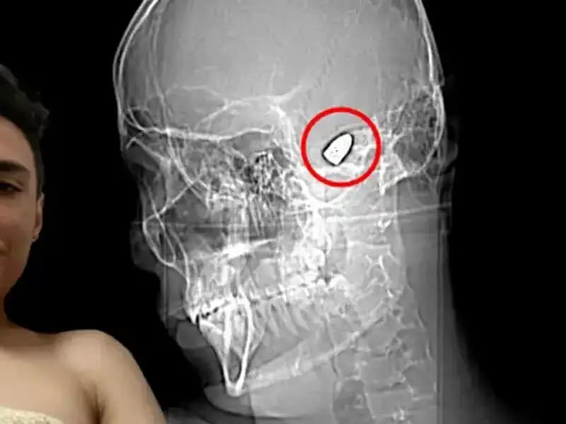 Hayatıyla Yarışan Genç: Kafasında Patlayan Bir Sır Var