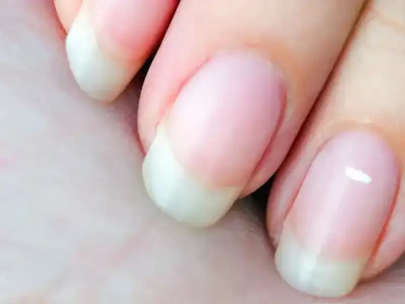 Tırnaklarınız Geleceğinizi Mi Gösteriyor? Uzmanlar Açıklıyor!